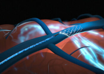 Elon Musk’s Neuralink Begins Implanting Brain Chips in Humans in 2022: The Implications and Risks” on RajkotUpdates.news