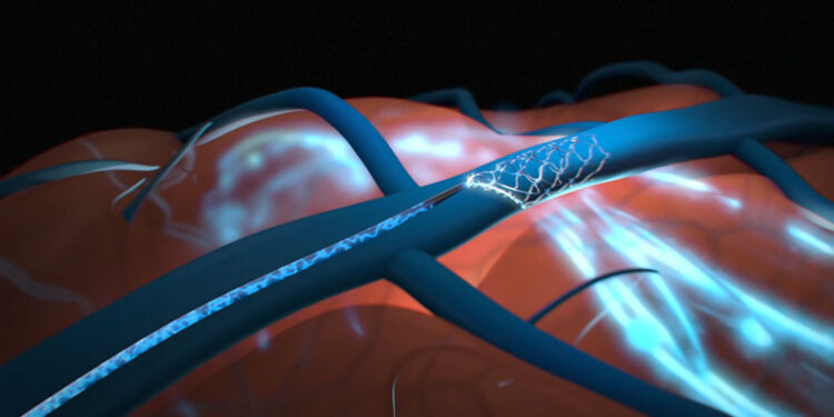 Elon Musk’s Neuralink Begins Implanting Brain Chips in Humans in 2022: The Implications and Risks” on RajkotUpdates.news